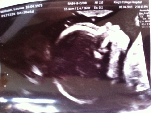 Baby2small_zps085d635a.jpg
